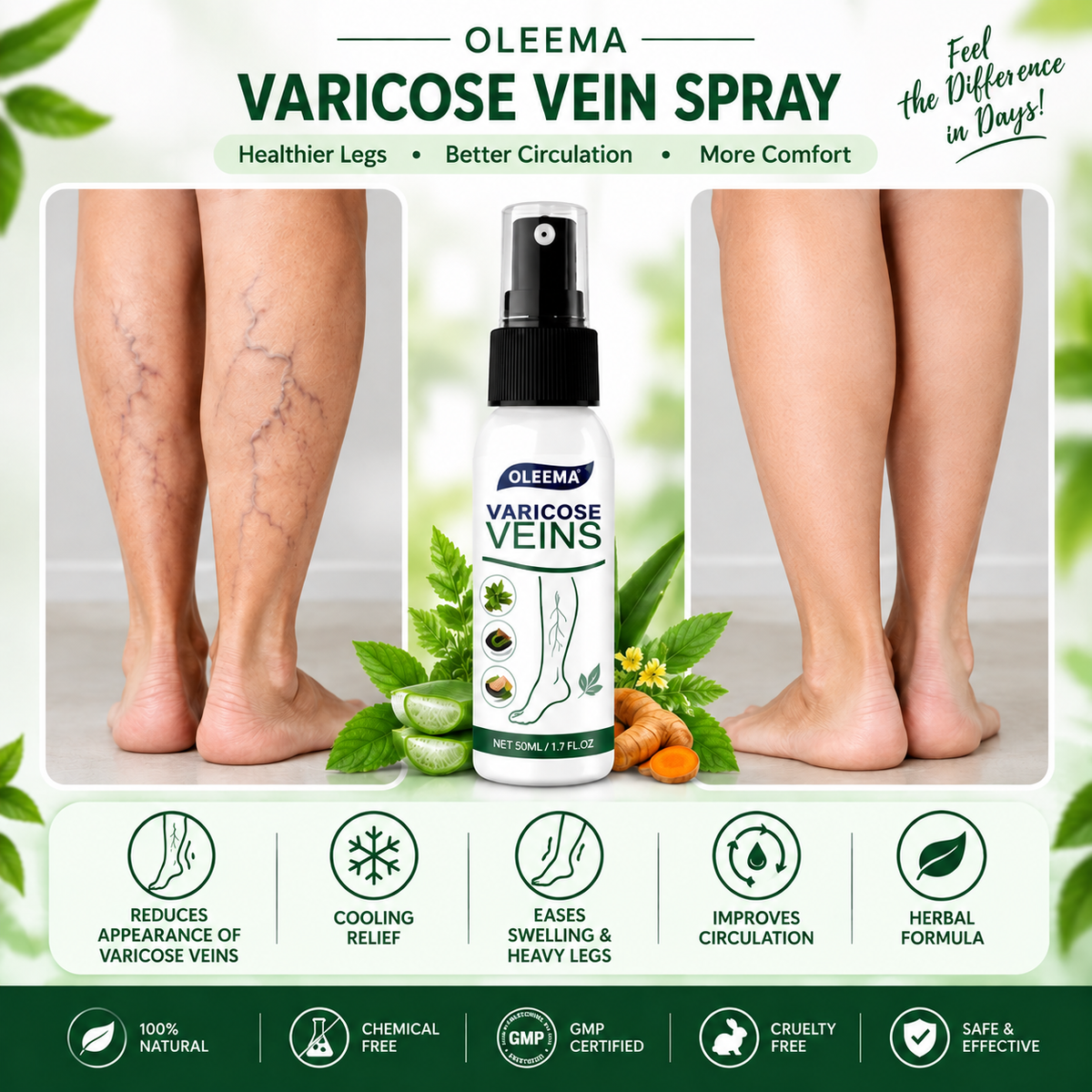 MD Varicose vein spray Targeted Care. Easy Application. Better Leg Comfort.