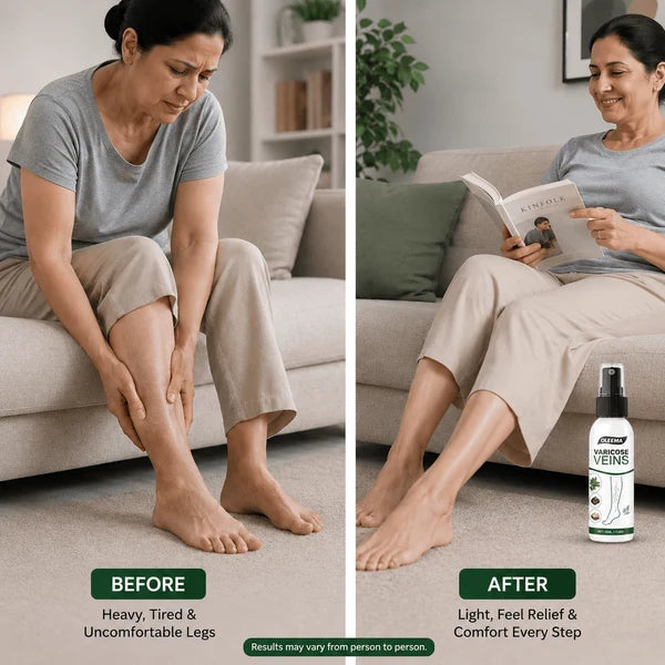 MD Varicose vein spray Targeted Care. Easy Application. Better Leg Comfort. Promo Banner
