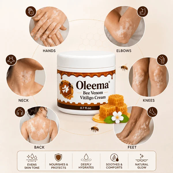 MD Oleema Advanced Vitiligo Restore Cream ✨ | Buy 1 Get 1 Free Promo Banner