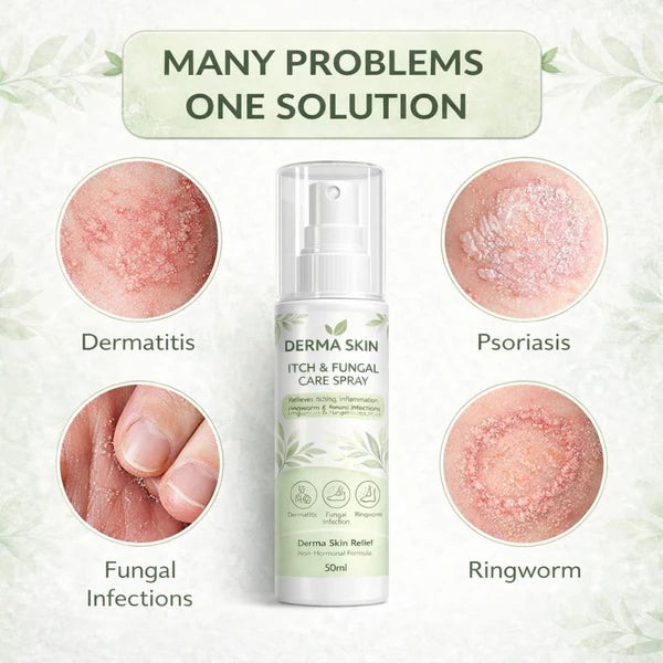 MD Fungal Care Spray- Dermatologist Inspired Itch & Fungal Care👨🏽‍⚕️ Promo Banner