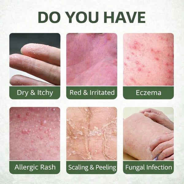 MD Fungal Care Spray- Dermatologist Inspired Itch & Fungal Care👨🏽‍⚕️