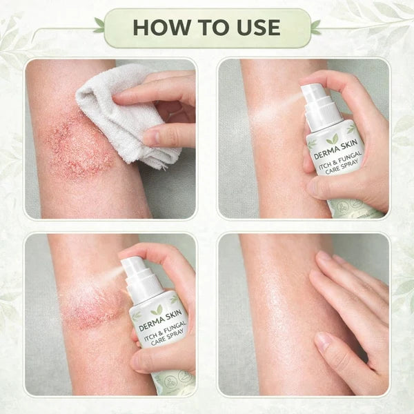 MD Fungal Care Spray- Dermatologist Inspired Itch & Fungal Care👨🏽‍⚕️