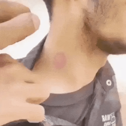 MD Fungal Care Spray- Dermatologist Inspired Itch & Fungal Care👨🏽‍⚕️