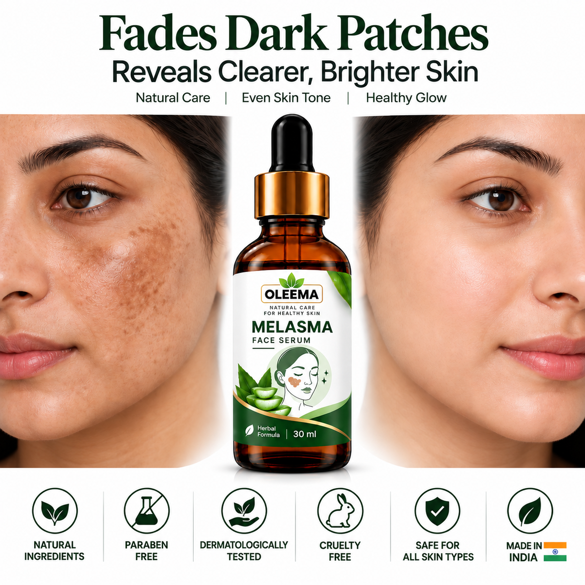 Oleema melasma serum Clearer-Looking Skin Starts With Consistent Care