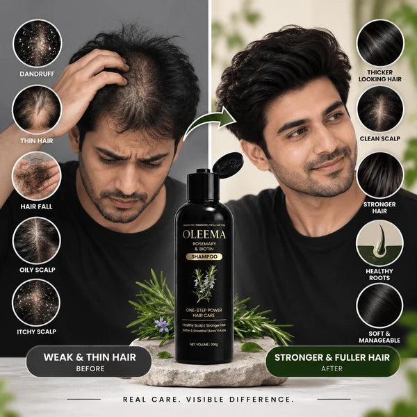 MD OLEEMA Rosemary & Biotin Shampoo — for softer, stronger, naturally healthy-looking hair.